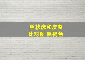 丝状疣和皮赘比对图 黑褐色